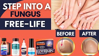 Best Toenail Fungus Treatments  Step into A FungusFree Life [upl. by Eselehs43]