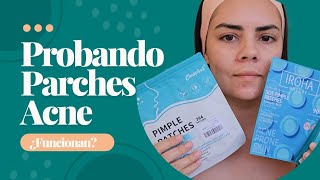 Los Mejores PARCHES para GRANOS ¿Cómo Funcionan ¿Eliminan el ACNE Compeed Iroha Pimple Patches [upl. by Retsel]