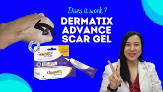 How To Reduce Scars with Dermatix Advanced Scar Gel [upl. by Aitrop492]