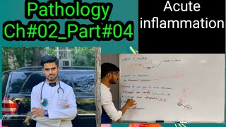 ACUTE INFLAMMATION44PathologyCh02Part04 [upl. by Eppilihp667]