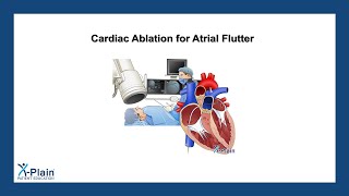 Cardiac Ablation for Atrial Flutter [upl. by Verlee854]