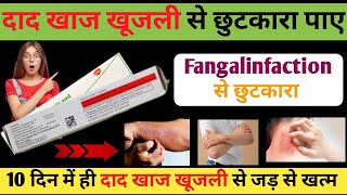 दाद खाज खुजली से छुटकारा पाए Fangalinfaction से छुटकारा Tenovate GN Cream Uses in hindi Riview [upl. by Hoffman795]