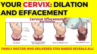 Cervical dilation and cervical effacement everything you need to know about your cervical exam [upl. by Mccreery]