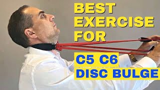 Best Exercises For C5 C6 Bulging Disc  C5 C6 Herniated Disc Exercises by Dr Walter Salubro [upl. by Natanoj461]