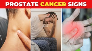 The Most Critical Signs of Prostate Cancer [upl. by Ennej]