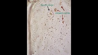 Práctica de la observacion de Plastidios Observation of plastids [upl. by Foskett]