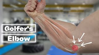 5 BEST Exercises For Golfers Elbow Rehab TRY THESE [upl. by Irehj544]