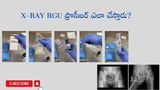 How to do X Ray RGU procedure rgu xray xrays xrayrgu rgv mcug xrayhsg aiims aiimsjobs brs [upl. by Lenad249]