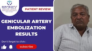 Genicular artery embolization results [upl. by Lozar143]