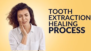 Tooth Extraction Healing Process 10 Tips For Fast Recovery [upl. by Ojibbob]