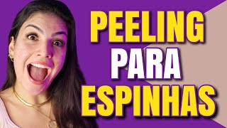 QUAL MELHOR PEELING PARA ESPINHAS ACNE [upl. by Russ749]