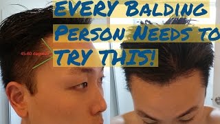 Every Balding Person NEEDS TO TRY THIS [upl. by Bohrer707]