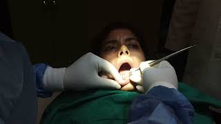 flap surgery for gums  periodontal surgery at best dental clinic in patna magadh oro dental clinic [upl. by Niatsirhc]