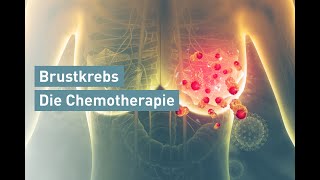 Brustkrebs Die Chemotherapie [upl. by Budge]