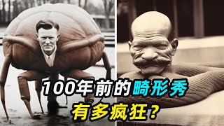 100年前的畸形秀有多疯狂？揭秘全球最可怕的5个畸形人 [upl. by Alinna]