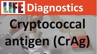 Cryptococcal antigen CrAg testing  Biosynex CryptoPS [upl. by Gypsy670]