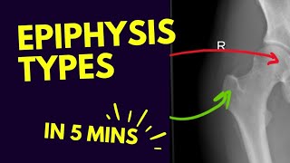 Types of Epiphysis 🦴  In FIVE 5️⃣ Minutes [upl. by Holton]