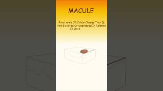 What is Macule Papule and Nodule  Common Oral Pathology Terms  Basic Viva Qs  shorts [upl. by Howard]