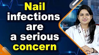 Nail infections bacterial or viral are a serious concern [upl. by Tyrus183]