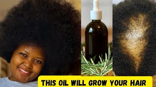 Rosemary oil for hair growth  Grow your Hair Long and Thick with Rosemary Oil [upl. by Stanislaus]