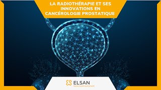 Cancer de la prostate  la radiothérapie et ses innovations en cancérologie prostatique [upl. by Funch]