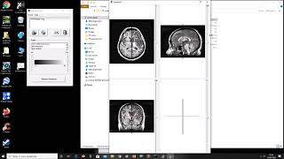 Terminale S SVT  tp eduanatomist [upl. by Notsrik352]