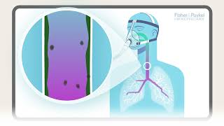 How does humidity support the lungs  FampP Healthcare [upl. by Seugirdor]