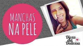 Manchas na Pele  DICAS DA DEDESSA [upl. by Allit]