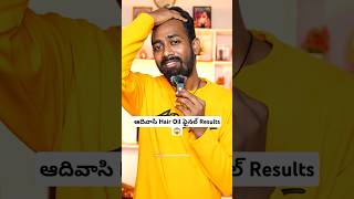 Adivasi Hair Oil Review and Results in Telugu  Hakki Pikki Hair Growth Oil shravangoudvlogs [upl. by Iddo237]