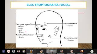 Electrocardiograma y Electromiograma [upl. by Lustig]