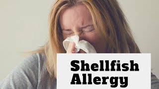 Shellfish Allergy What Are the Symptoms [upl. by Rabassa]