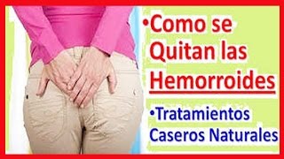 Hemorroides Externas e Internas Tratamiento  Como Curar las Hemorroides Remedios Caseros [upl. by Sirtemed]