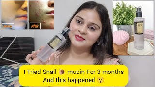 What is Snail 🐌mucin  Cosrx snail 96 mucin power Essence Review  is snail mucin good for skin [upl. by Friedman]