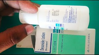 Desowen lotion desonide lotion uses side effects complete info Desonide cream 005 Desonide cream [upl. by Thilde]