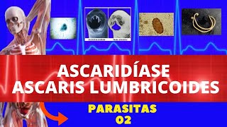 ASCARIDÍASE  ASCARIS LUMBRICOIDES LOMBRIGA  PARASITOLOGIA  INFECTOLOGIA [upl. by Aliuqaj]