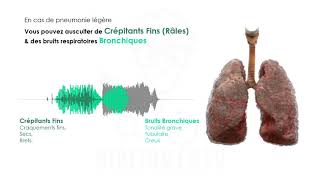 Ecoutez les Bruits Respiratoires au Cours du COVID19 [upl. by Berny]