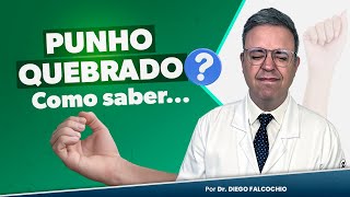 Como saber se o seu punho está quebrado [upl. by Inava561]