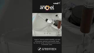 Arthrex Angel System®️ [upl. by Ardyce]