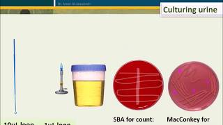 Urine Culture How To Interpret Count [upl. by Aihtenyc]