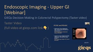 GIEQs Decision Making in Colorectal Polypectomy Taster video [upl. by Yrocej]