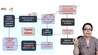 E6 Sample Video Toxoplasmosis and Neurocysticercosis Microbiology [upl. by Oretos650]