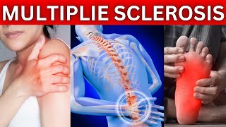 12 Early Warning Signs of Multiple Sclerosis You Shouldnt Ignore MS [upl. by Ivad645]