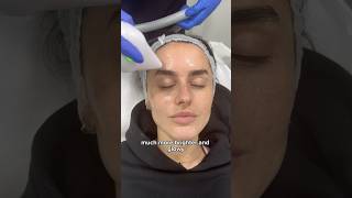 Amber Davies 4th Session of Endymed Facial Tightening Treatment at Dr MediSpa [upl. by Blithe]