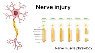 Nerve injury  Sedon and Sunderland classification of nerve injury [upl. by Drazze]