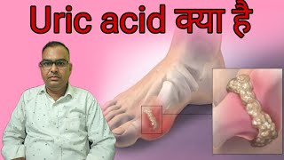 uric acid kya hai । क्यों होता है । iske side effect kya dekhne ko milte Hain [upl. by Roel]