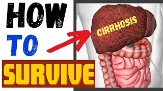 Liver Cirrhosis How To Live With Liver Cirrhosis [upl. by Ocinemod]