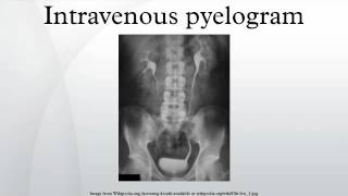 Intravenous pyelogram [upl. by Yeltihw964]