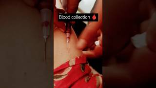 Syringe blood collection🩸💉 open system How to take blood from veins💉🩸bloodtest shorts status [upl. by Notsud]