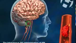 Tissue Plasminogen Activator TPA [upl. by Peder102]