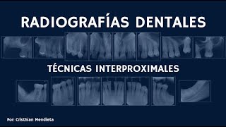 RADIOGRAFÍAS DENTALES  Técnicas Intraorales [upl. by Eugilegna]